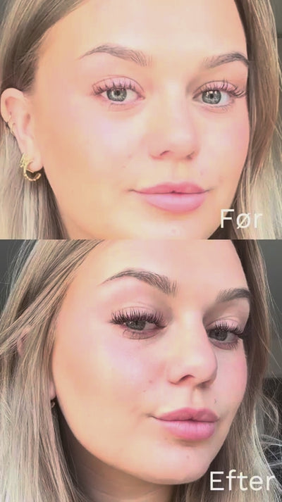 Video 1