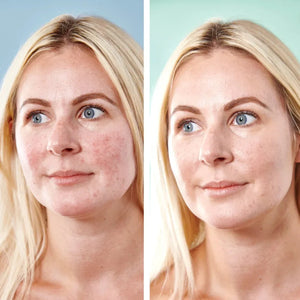 Sorted Skin - 5 in 1 Anti-Redness Day Cream SPF50 | 30 ml